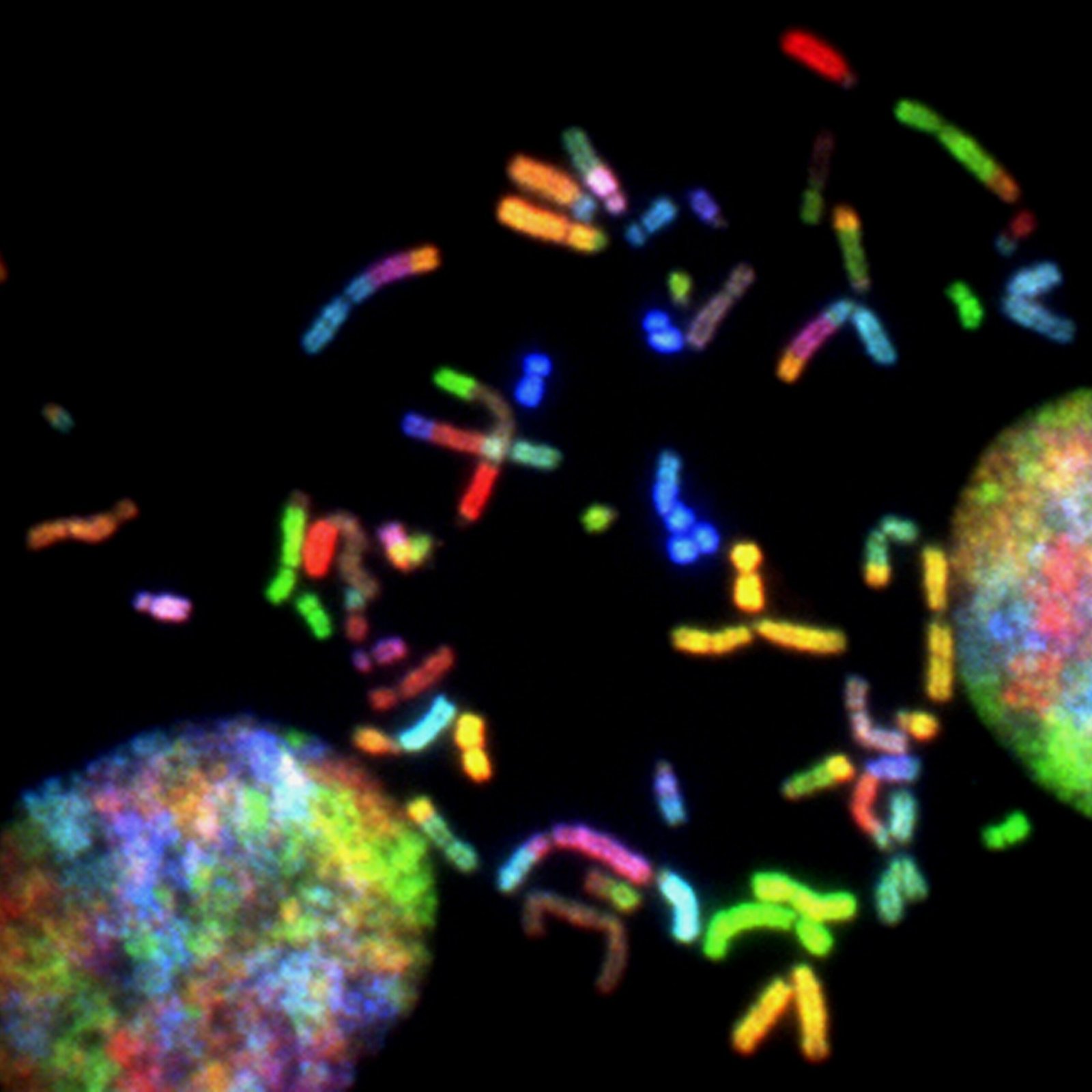 The Meaning and Significance of Chromosome